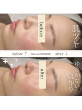 サロンドリシェス(Salon de RICHESSE)/お肌の土台から改善REVIハーブ♪