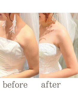 ビューティースリム タニダ/