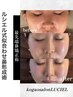 【鼻筋・小鼻を整える】最先端小顔術×美鼻矯正術
