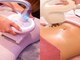 アルメリア(Armeria)の写真/【贅肉にお悩みの大人女性必見】エンダモロジー30分+サーモシェイプdeep30分特別価格！！理想の身体へ♪