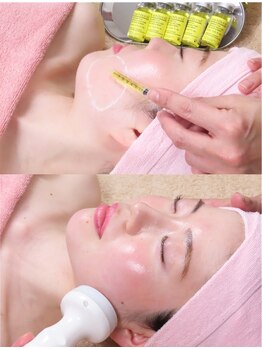 エステティックサロン フェアリー(ESTHETIC SALON FAIRLY)の写真/類なし最強小顔◎Vリフト小顔矯正(脂肪燃焼)×《レモンボトル》の最強コラボは希少!最新ダイエット☆