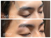 クラシックス(CLASSICS)/美眉脱毛