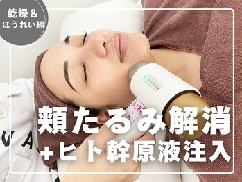 ヴァカンス 梅田阪急17番街店(VACANCES)/最先端のヒト幹細胞フェイシャル