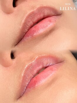 ウィズリリナ 新横浜(with Lilina.)/ローマピンク導入記念