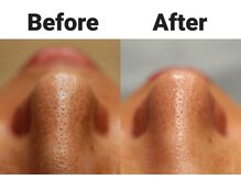 ミモザの雰囲気（目に見えないほどの細かいスチームで毛穴の奥までしっかり洗浄！）