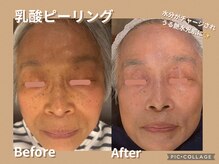 ボディリカバリー(Bodyリカバリー)/