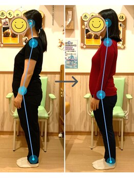 すぎうら整体院 浜松院/体型と姿勢の変化