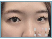 コトタリル/LEDマツエク