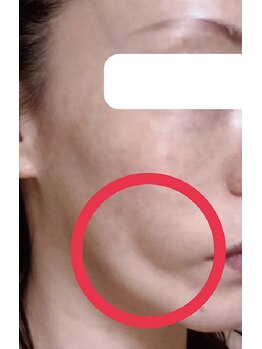 ツクヨミ/フェイスリフト