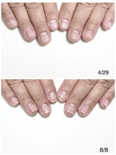 ルクレール カシェット(Le clair cachette)/自爪育成3ヶ月コース