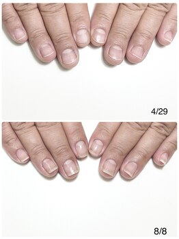 ルクレール カシェット(Le clair cachette)/自爪育成3ヶ月コース