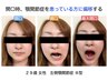 【食いしばりが気になる方必見！！】☆顎の関節の施術☆　6500→4400円