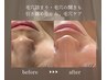 【口コミ割引】陶肌トリートメント