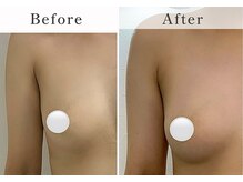 バストアップ専門サロン D'cielの雰囲気(30代のお客様ハンドのみワンクール/お胸のボリュームアップ)