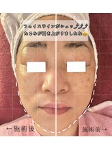 ルミナス(Luminous)/美肌＆小顔