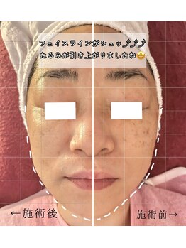 ルミナス(Luminous)/美肌＆小顔