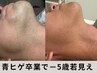 【青ヒゲ卒業でマイナス5歳若見え】メンズ髭脱毛♪仕事できる男の身だしなみ