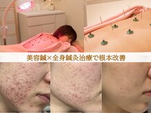 ネテマテ 表参道(netemate)の雰囲気（丁寧なカウンセリングを行います。(東洋医学・体質診断付き)）
