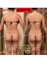 アユスリム(AYU SLIM)/短期集中ケア　充実痩身♪