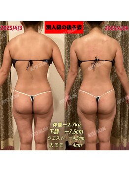 アユスリム(AYU SLIM)/短期集中ケア 充実痩身♪