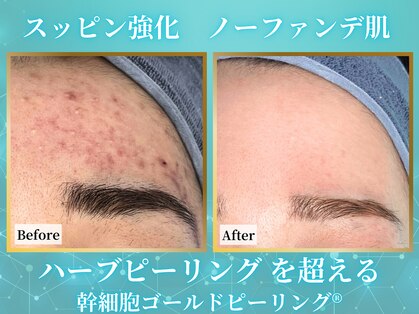 リメイククリニカルビューティー(Remake clinical beauty)の写真