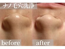 VS28スキンケアスタジオ バリイン 千葉(BALI IN)の雰囲気(たった1回で◎繰り返せば肌質が変化するのを感じられます♪)