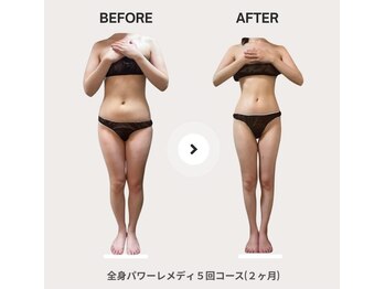 ビループ(biloop)/《短期痩せ》驚きの変化を♪