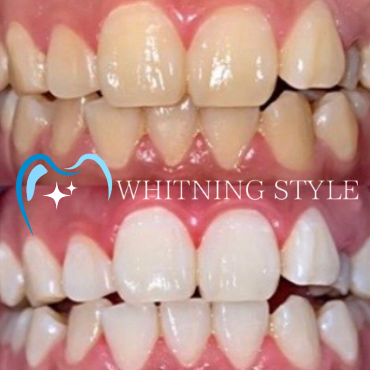 ホワイトニングスタイル 柏店｜ホットペッパービューティー