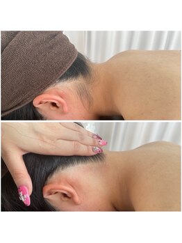 ミース 北九州店/うなじ◎ビフォーアフター