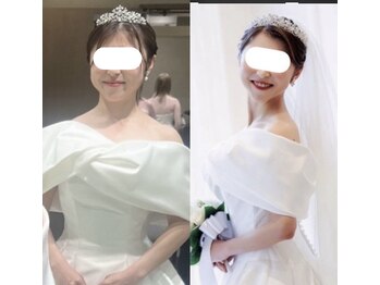 凛&美 銀座/7回施術のビフォーアフター