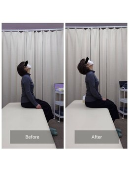 ナオル整体 札幌白石院(NAORU整体)/猫背・姿勢チェック｜改善例