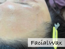 ミナノンノ(mina.nonno)/おでこもちゅるちゅる♪