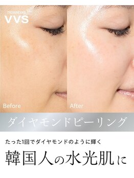 リベレ(Libelle)/毛穴・ニキビ・シミ・シワに効く