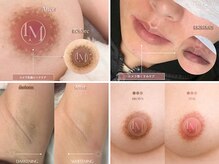 エルビービュティーサロン(LB BEAUTY SALON)