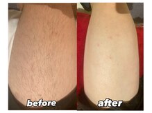 ルミエール(LUMIERU)/