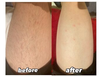 ルミエール(LUMIERU)/