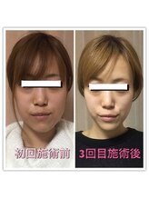 ラ アクサル(la.akthar)/小顔　全身　骨格矯正　整体