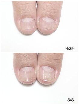 ルクレール カシェット(Le clair cachette)/美爪育成3ヶ月コース