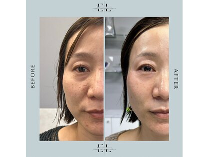 ソエルテの写真