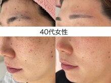 サクラ 本厚木駅前店(SAKURA)/本厚木シミケア/伊勢店シミケア