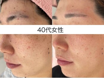 サクラ 本厚木駅前店(SAKURA)/本厚木シミケア/伊勢店シミケア