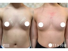 ハレオラ(HaleOla)/20代☆努力の賜物です♪