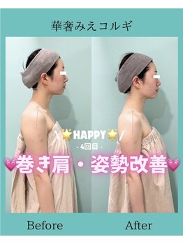 アコガレコガオ 鳥取店/コルギのビフォーアフター