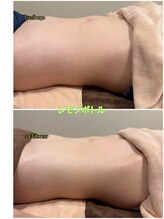 ディアウーマン(Dear Woman)/【スリミラボディ】お腹