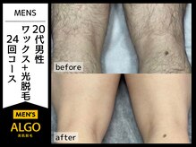 アルゴ 小松店(ALGO)/部分脱毛も★（30代男性）