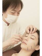 心 こころ/美容鍼