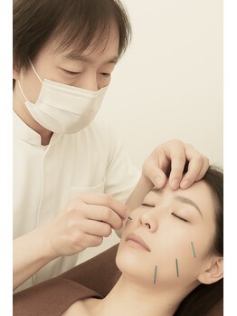 心 こころ/美容鍼