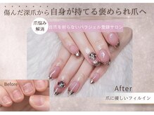 ティアラネイル 宇都宮