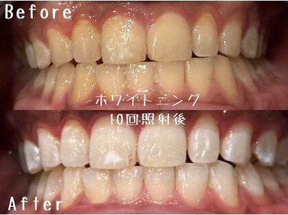 アデル 久留米(ADEL)の写真