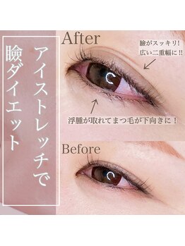 イチマルゴ ガーデン(105 GARDEN)/アイストレッチ